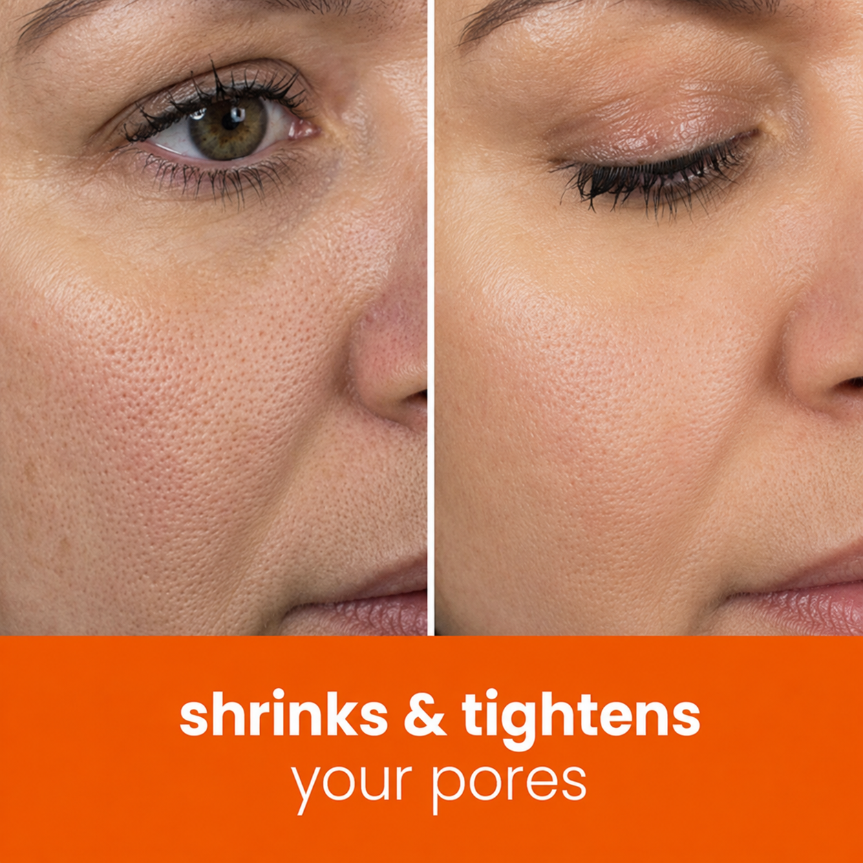 🔥Last Day 68% OFF-Virginca Turmeric Kojic Glow Pads