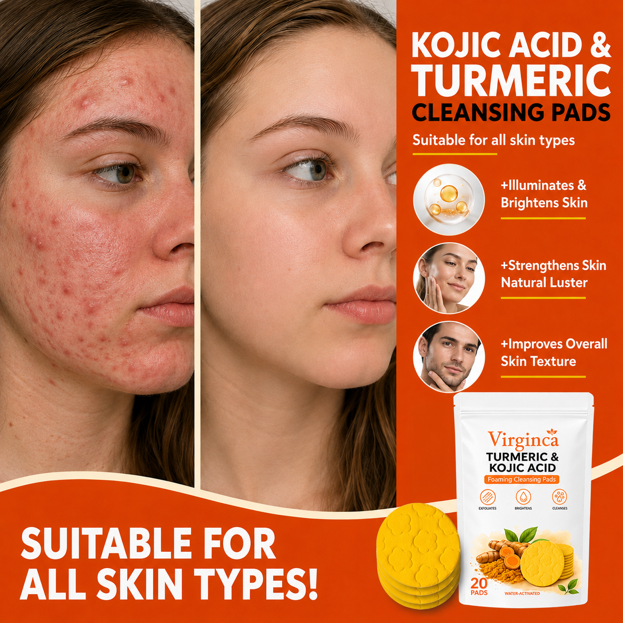 🔥Last Day 68% OFF-Virginca Turmeric Kojic Glow Pads